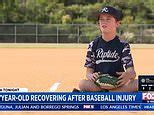 Southern California boy undergoes brain surgery after taking baseball to head